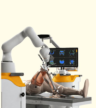 Velys Robotic Arm